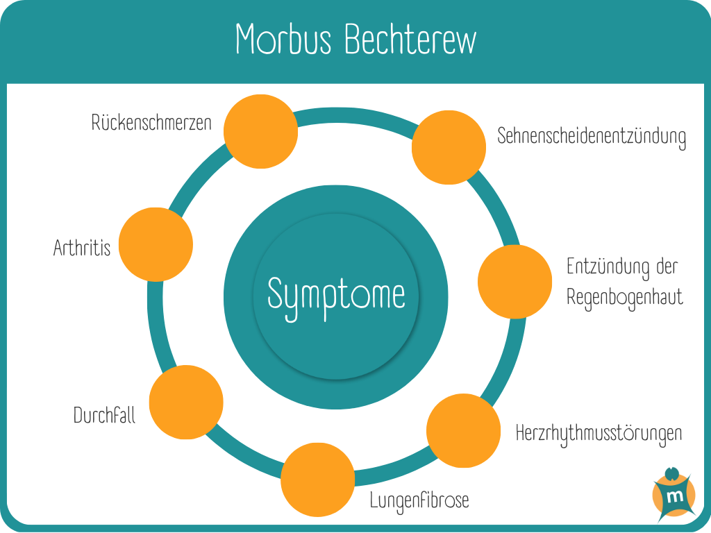 Morbus Bechterew | Ihre Apotheke informiert › Info-Seite - medikamente -per-klick