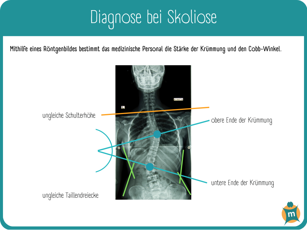 Diagnose mittels Röntgenbild