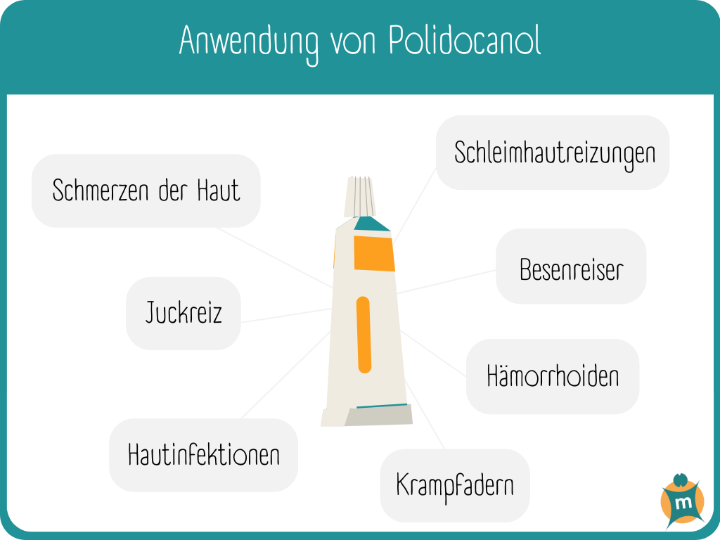 Infografik zur Anwendung von Polidocanol